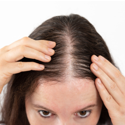 skincore female hair loss
