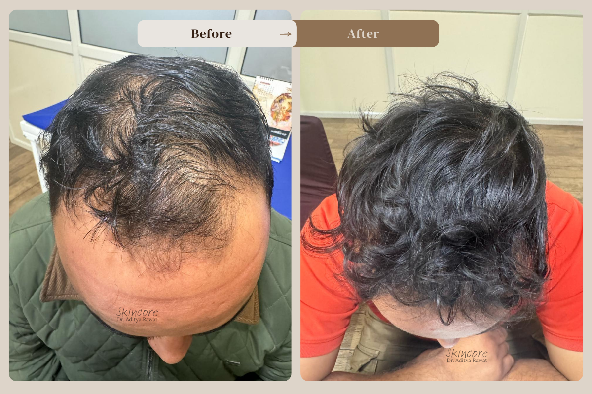 Skincore before after treatment