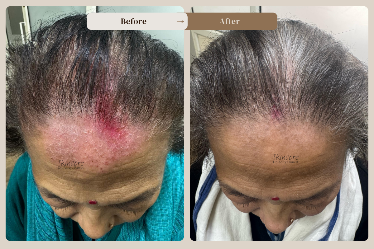 skincore before after treatment