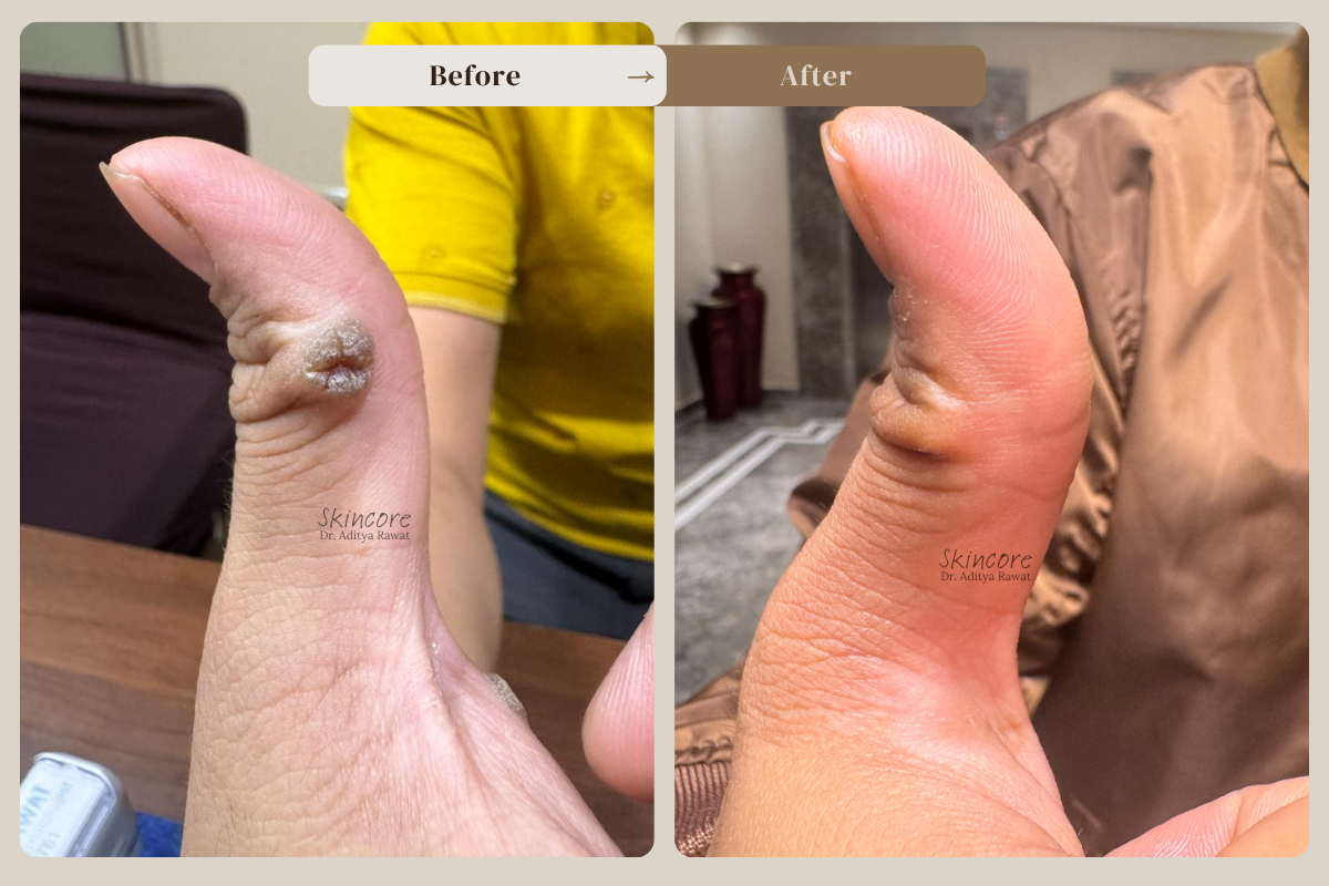 skincore before after treatment