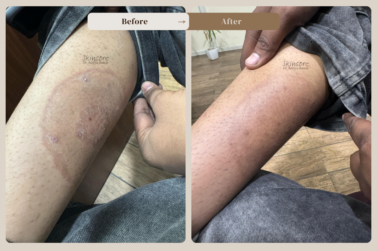 skincore before after treatment