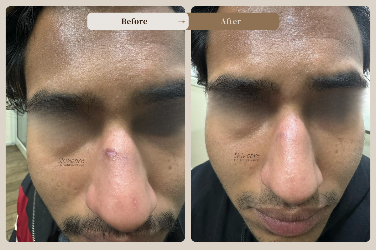 Skincore before after treatment